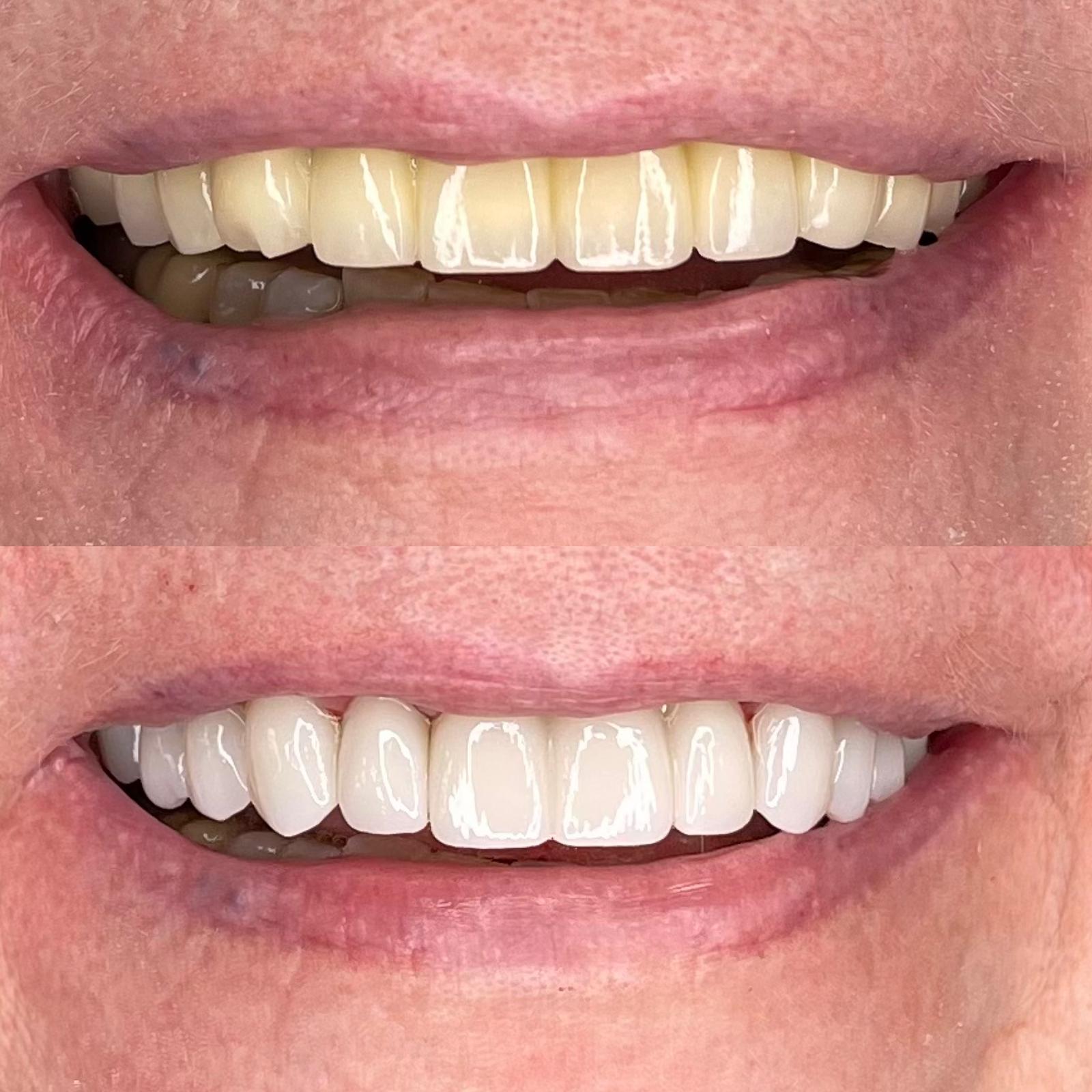 Case 30 — Color and Prominence